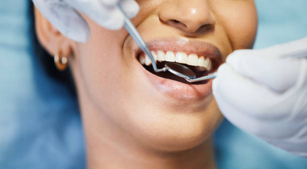 Best Emergency Tooth Extraction in Shrub Oak, NY